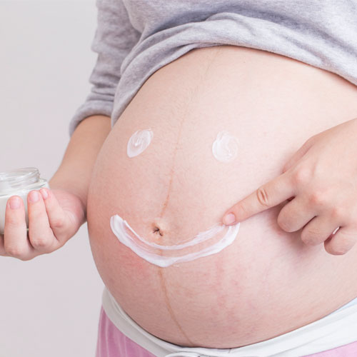 Las estrías en el embarazo son comunes por el excesivo estiramiento de la piel del abdomen durante este tiempo